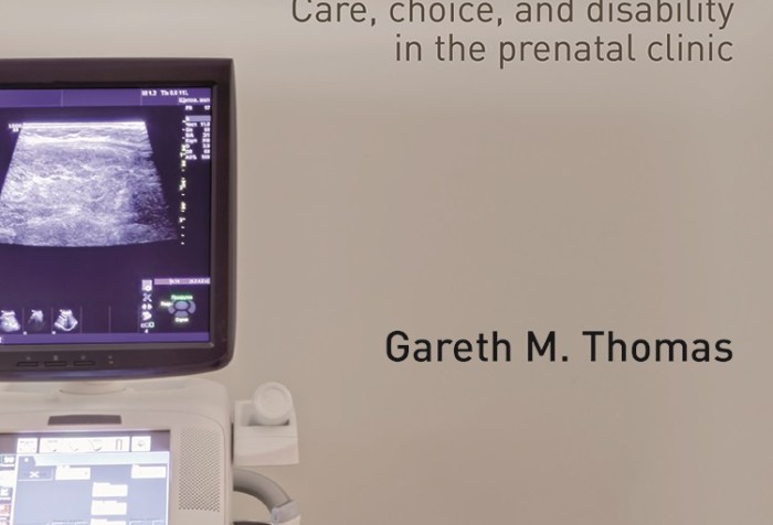 Book jacket for "Down's Syndrome Screening and Reproductive Politics: Care, Choice, and Disability in the Prenatal Clinic: Care, choice, disability in the prenatal clinic." The title is in black text against a white background. There is an ultrasound machine with a monitor showing something indistinguishable on the left-side of the image. Next to the ultrasound equipment is an exam table. The author's name, "Gareth M. Thomas" is in black text below the title.