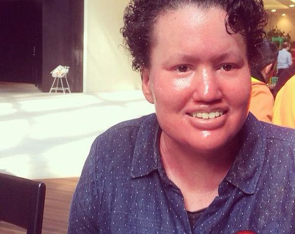 Young woman with curly short brown hair. Her skin is bright pink. She is wearing a blue long-sleeved shirt w/ a rainbow pin.